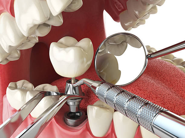 Best Knocked-Out Tooth Emergency  in Absecon Highlands, NJ